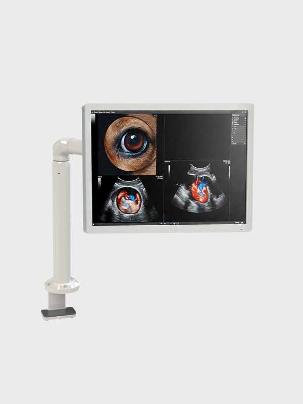 braccio monitor fisso medicale con configurazioni multiple per diagnostica ospedaliera